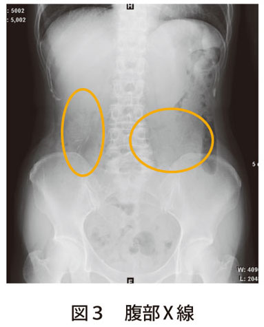 解答 解説 慢性的な腹痛です 原因を発見してください 実践 画像診断q A 羊土社 レジデントノート 実践 画像診断q A 羊土社 レジデントノート 羊土社