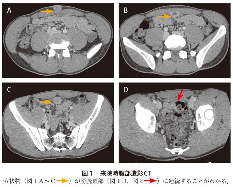 解答 解説 特徴的な部位に生じる疾患です 実践 画像診断q A 羊土社 レジデントノート 実践 画像診断q A 羊土社 レジデントノート 羊土社