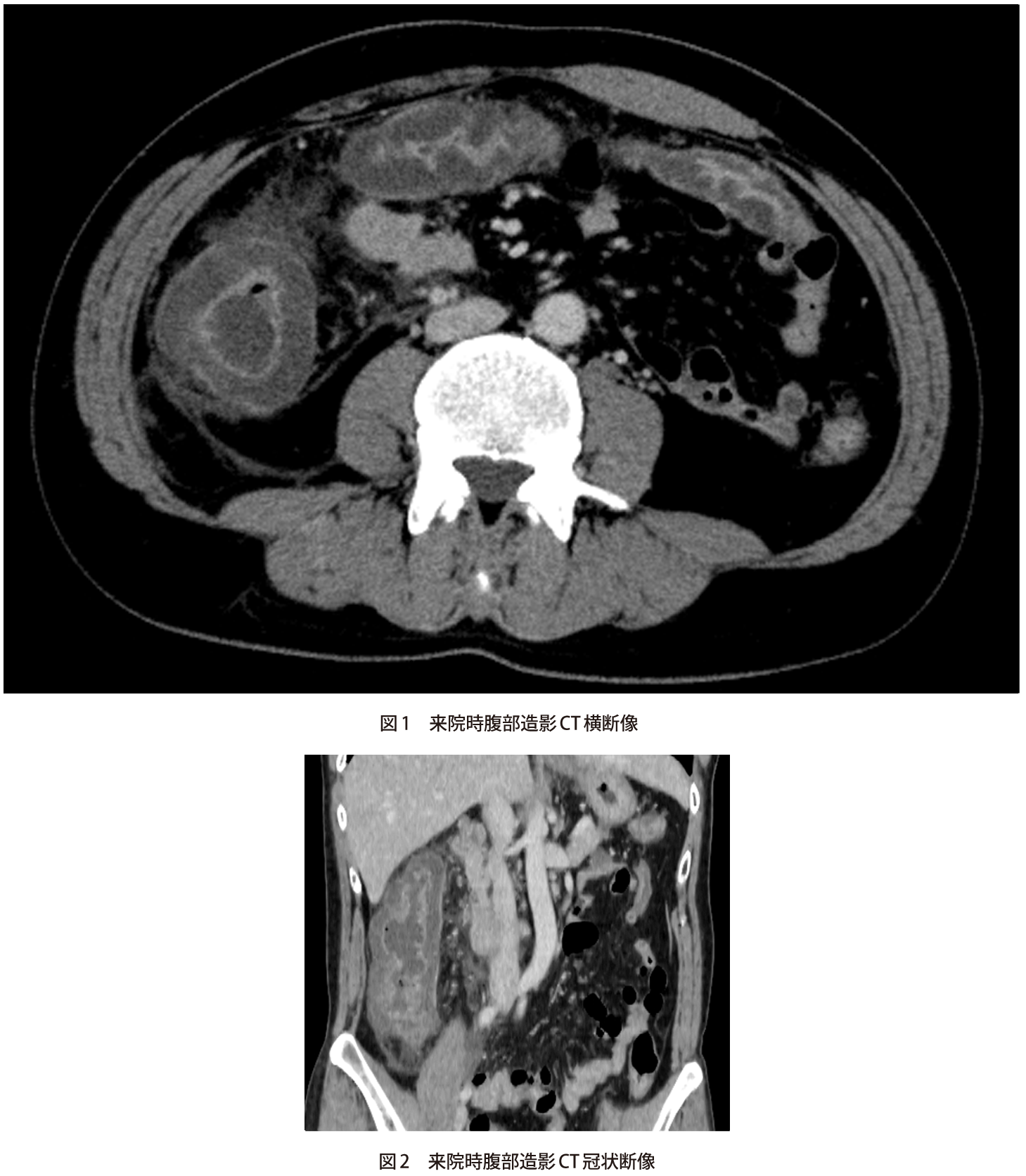 問題 腹痛 下痢 血便で受診した40歳代男性 腸炎の原因は 実践 画像診断q A 羊土社 レジデントノート 実践 画像診断q A 羊土社 レジデントノート 羊土社
