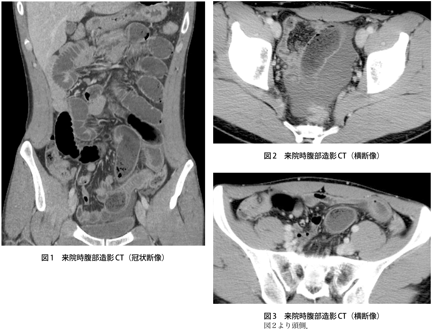 問題 下腹部痛で受診した歳代男性 原因は 実践 画像診断q A 羊土社 レジデントノート 実践 画像診断q A 羊土社 レジデントノート 羊土社