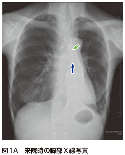 解答 解説 健診異常を主訴に受診した60歳代女性 実践 画像診断q A 羊土社 レジデントノート 羊土社
