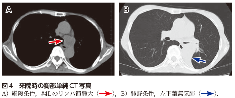 解答 解説 健診異常を主訴に受診した60歳代女性 実践 画像診断q A 羊土社 レジデントノート 羊土社