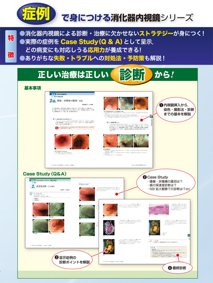 症例で身につける消化器内視鏡シリーズ
