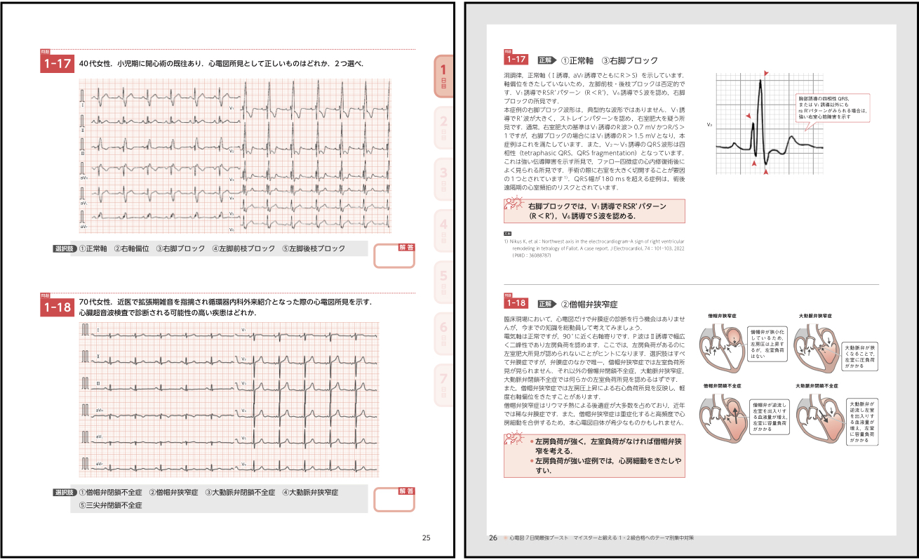心電図7日間最強ブースト_心電図完全攻略マニュアル_\"2冊セット\" 心電図7日間最強ブースト マイスターと鍛える1・2級合格への