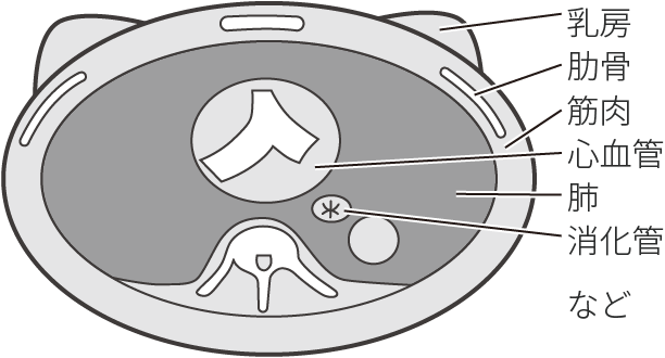 図5　胸部のCT断面に写っているもの