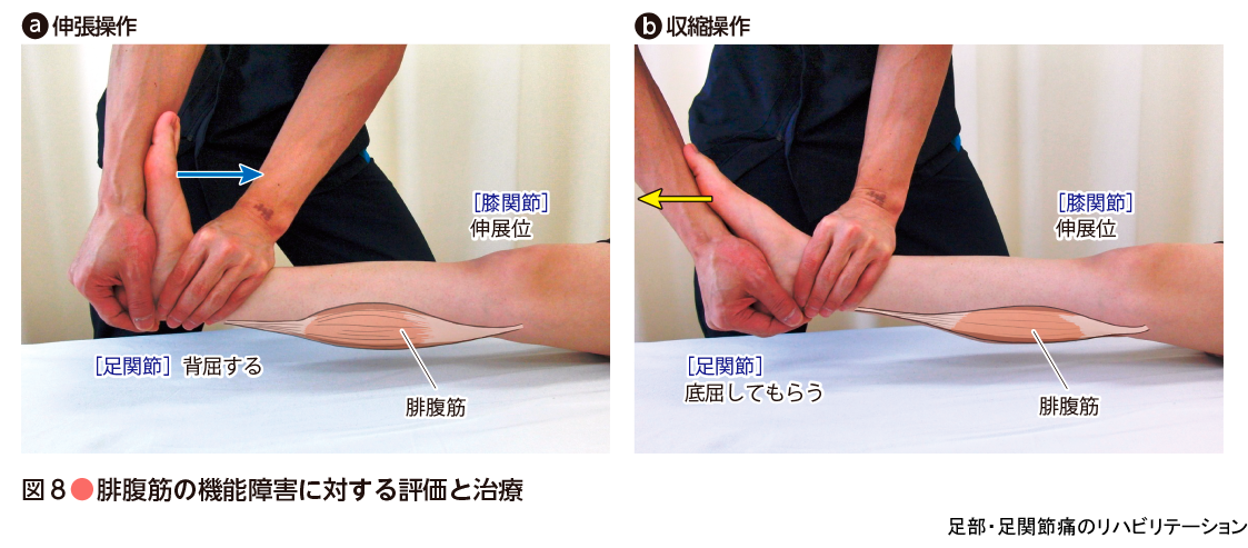 痛みの理学療法シリーズ 足部 足関節痛のリハビリテーション 羊土社