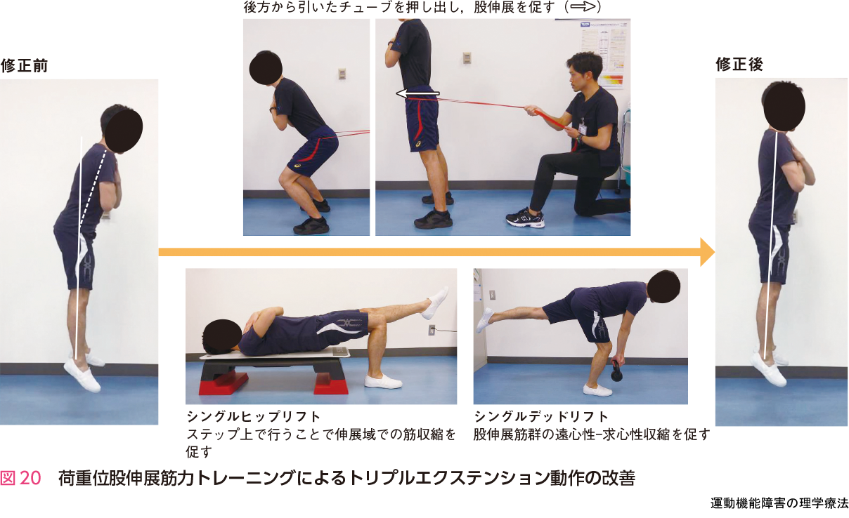 図20 荷重位股伸展筋力トレーニングによるトリプルエクステンション動作の改善