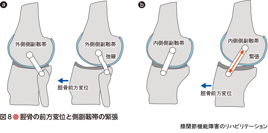 痛みの理学療法シリーズ：膝関節機能障害のリハビリテーション - 羊土社