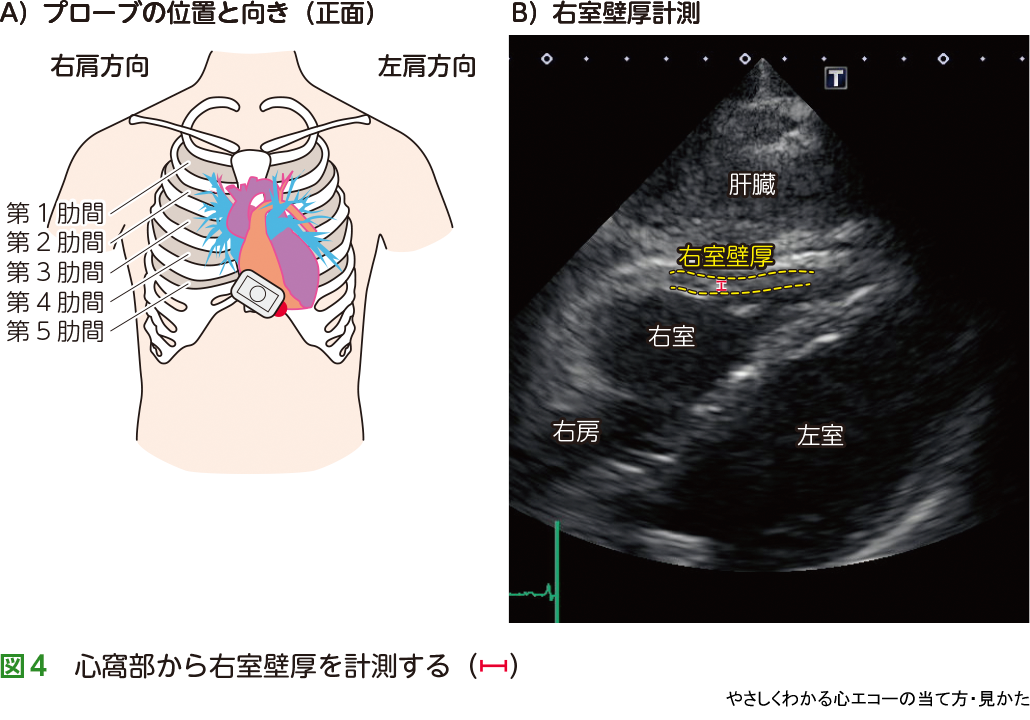 心窩 部 と は