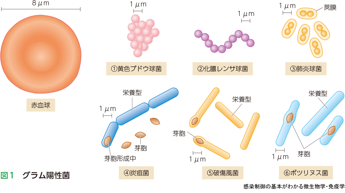 ブドウ球菌性髄膜炎の診断