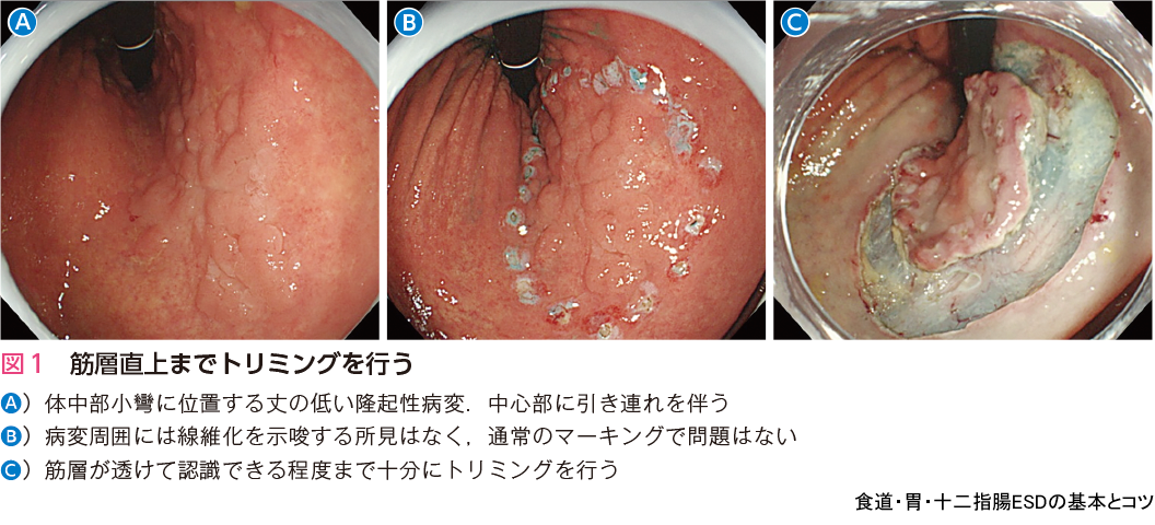 図1