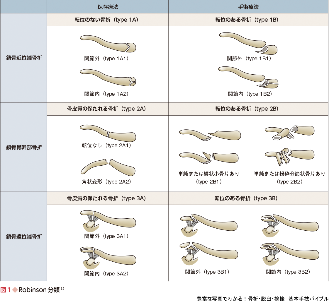 豊富な写真でわかる 骨折 脱臼 捻挫 基本手技バイブル 羊土社