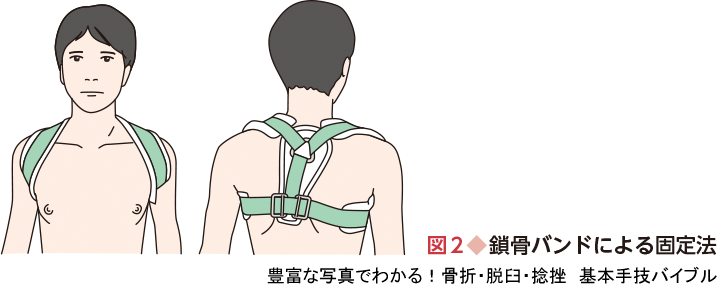 豊富な写真でわかる 骨折 脱臼 捻挫 基本手技バイブル 羊土社