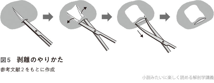 図5 剥離のやりかた