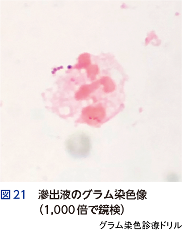 図21 滲出液のグラム染色像（1,000倍で鏡検）