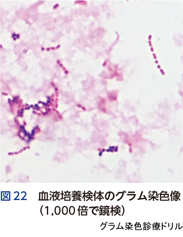 図22 血液培養検体のグラム染色像（1,000倍で鏡検）