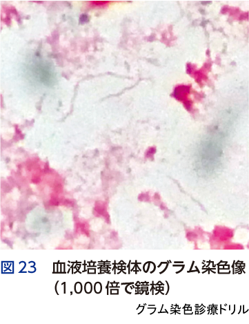 図23 血液培養検体のグラム染色像（1,000倍で鏡検）
