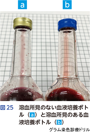 図25 溶血所見のない血液培養ボトル(a)と溶血所見のある血液培養ボトル(b)