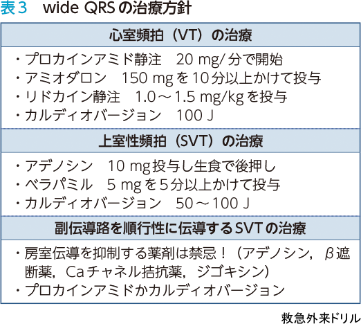 表3 wide QRSの治療方針