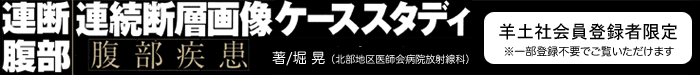 「連断腹部　連続断層画像ケーススタディ【腹部疾患】」羊土社HP会員登録者限定　※一部登録不要でご覧いただけます