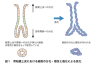 図1　胃粘膜上皮における細胞の分化・極性と癌化による変化